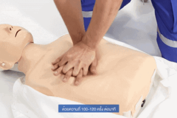 Cardiopulmonary Resuscitation - CPR
